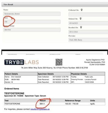 The image contains two separate medical test result documents. The top document shows a partial view of a testosterone serum test result. It indicates a value of 190, with a normal range of 264-916. The test was ordered on 05/16/2021 and resulted on 05/11/2021. The provider is listed as Ford, MD, Barry. The bottom document is a more detailed lab report from Trybe Labs, located in Kearny, NJ. It shows test results for a patient named Eric Calowell, born 08/29/1963. The test was for testosterone, with a specimen ID of 743696. The result shows 684.4 ng/dL, which falls within the reference range of 193.00 - 740.00 ng/dL. The test was collected on 09/15/2023 and reported on 09/18/2023. The ordering provider is listed as Lorraine Parrish. Both documents have red circles drawn around the testosterone result values.